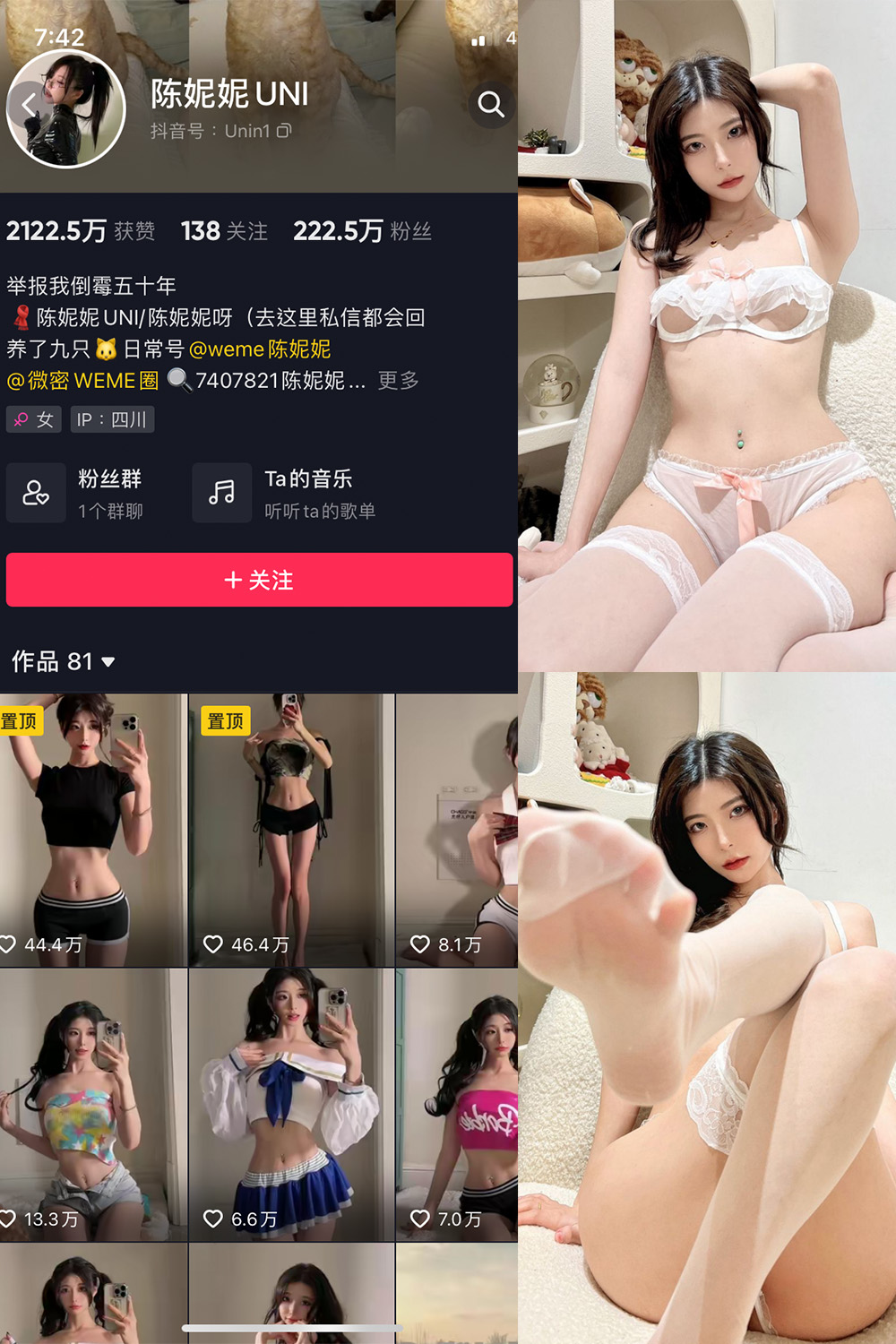 抖音 陈妮腻UNI 微密圈 NO.014期 【26P】-秀臀网-高品质图集网